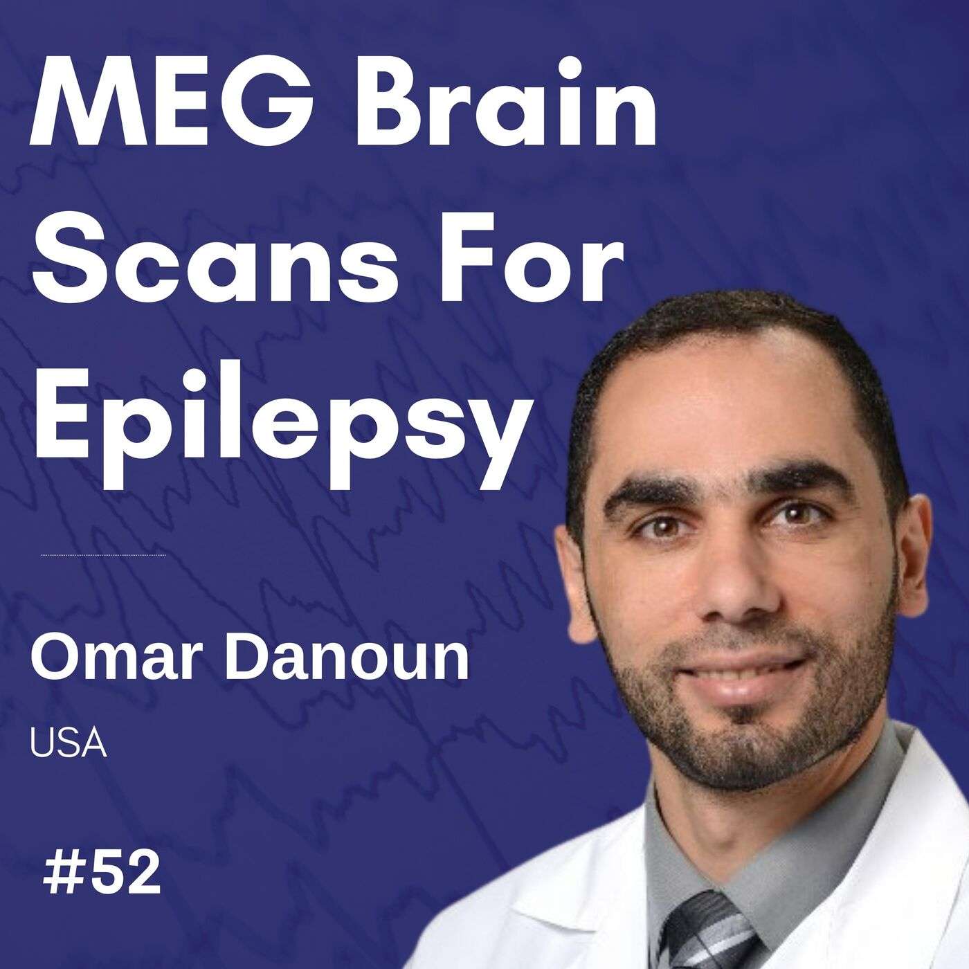 MEG Brain Scans For Epilepsy - Omar Danoun episode artwork