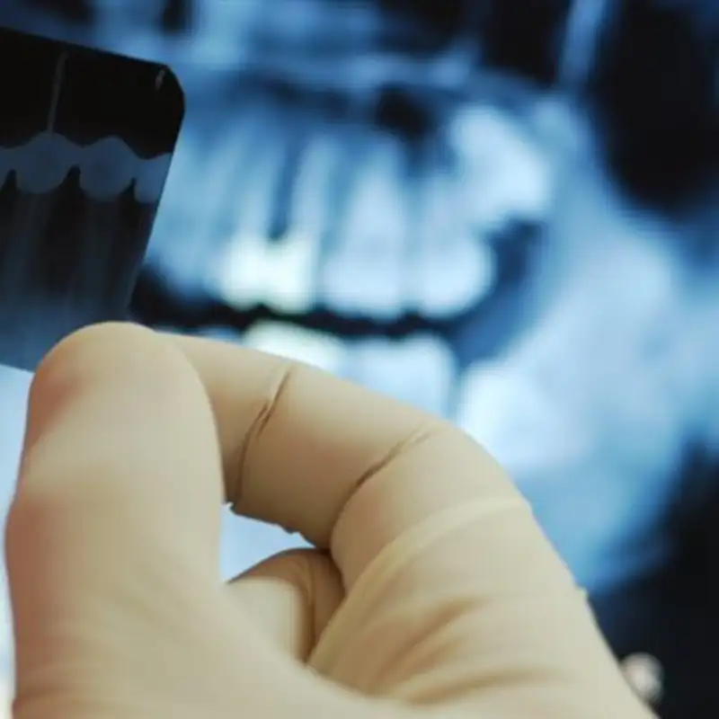 Le dentiste peut-il améliorer votre santé générale?