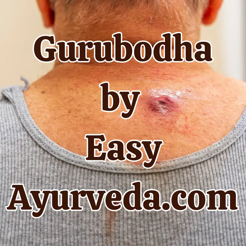 Gurubodha 181: Gandhaka Rasayana Indications| Combinations of different medicine forms| Auto immunity Ayurveda perspective