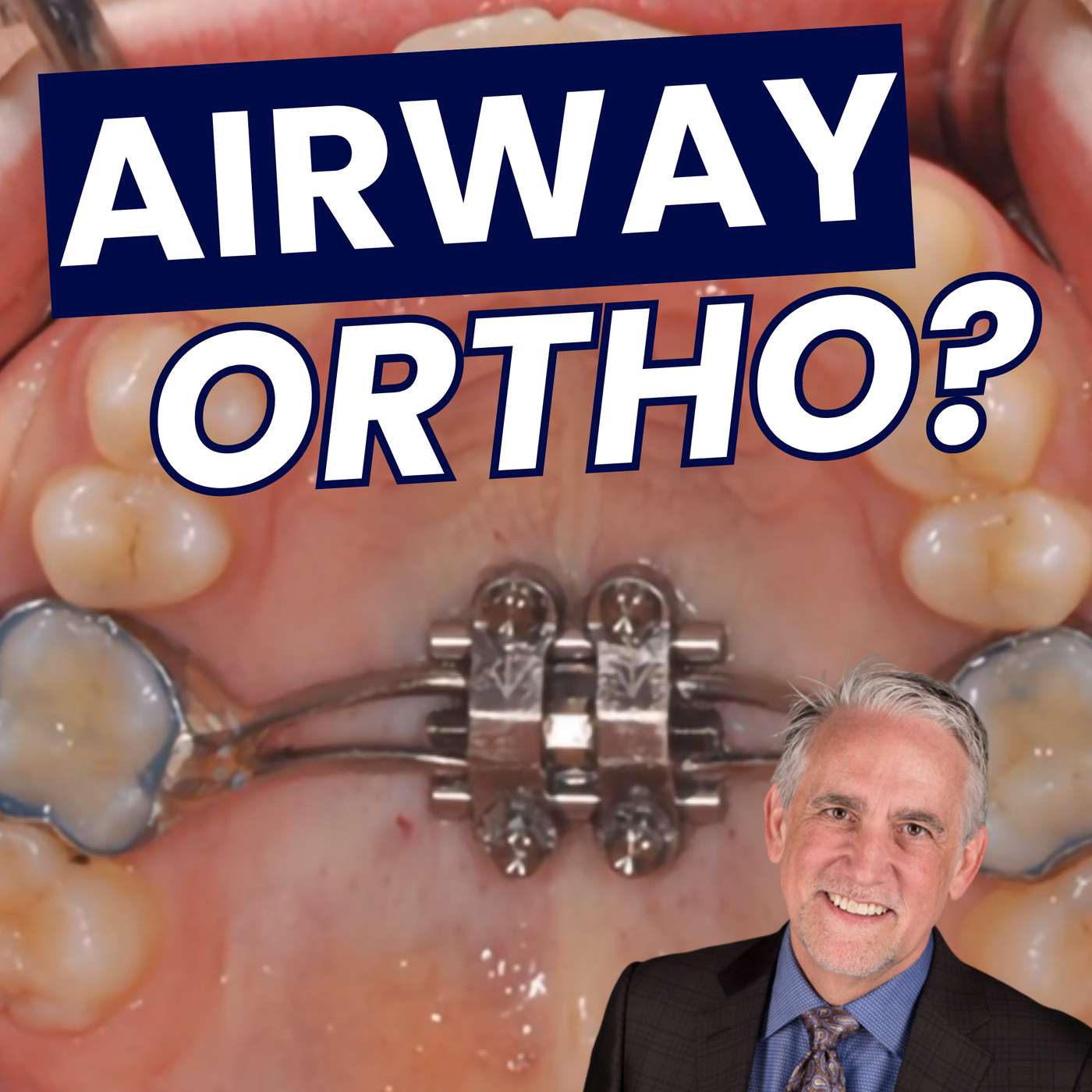 Airway Dentistry with Jeff Rouse – PDP229