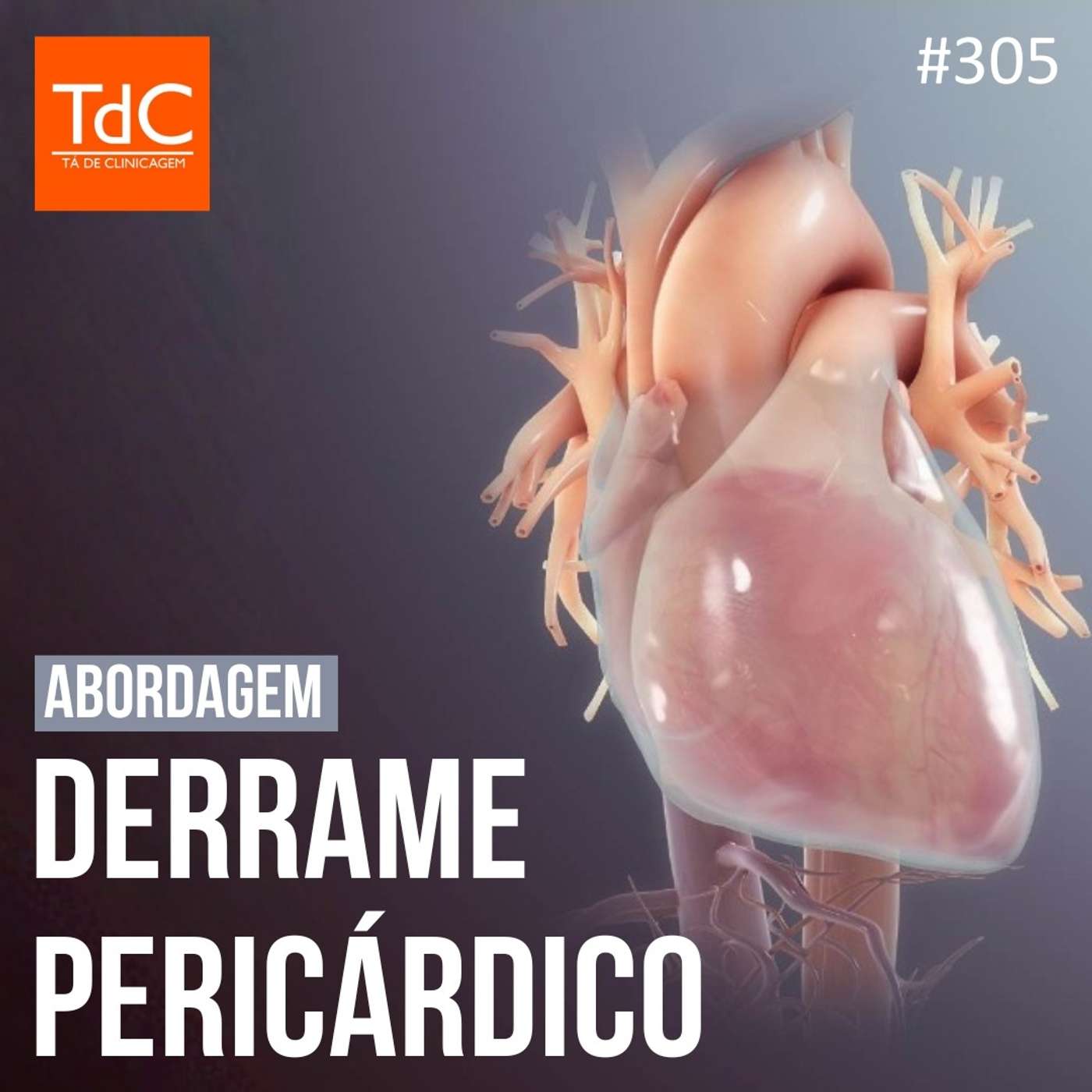 TdC 305: Abordagem de Derrame pericárdico