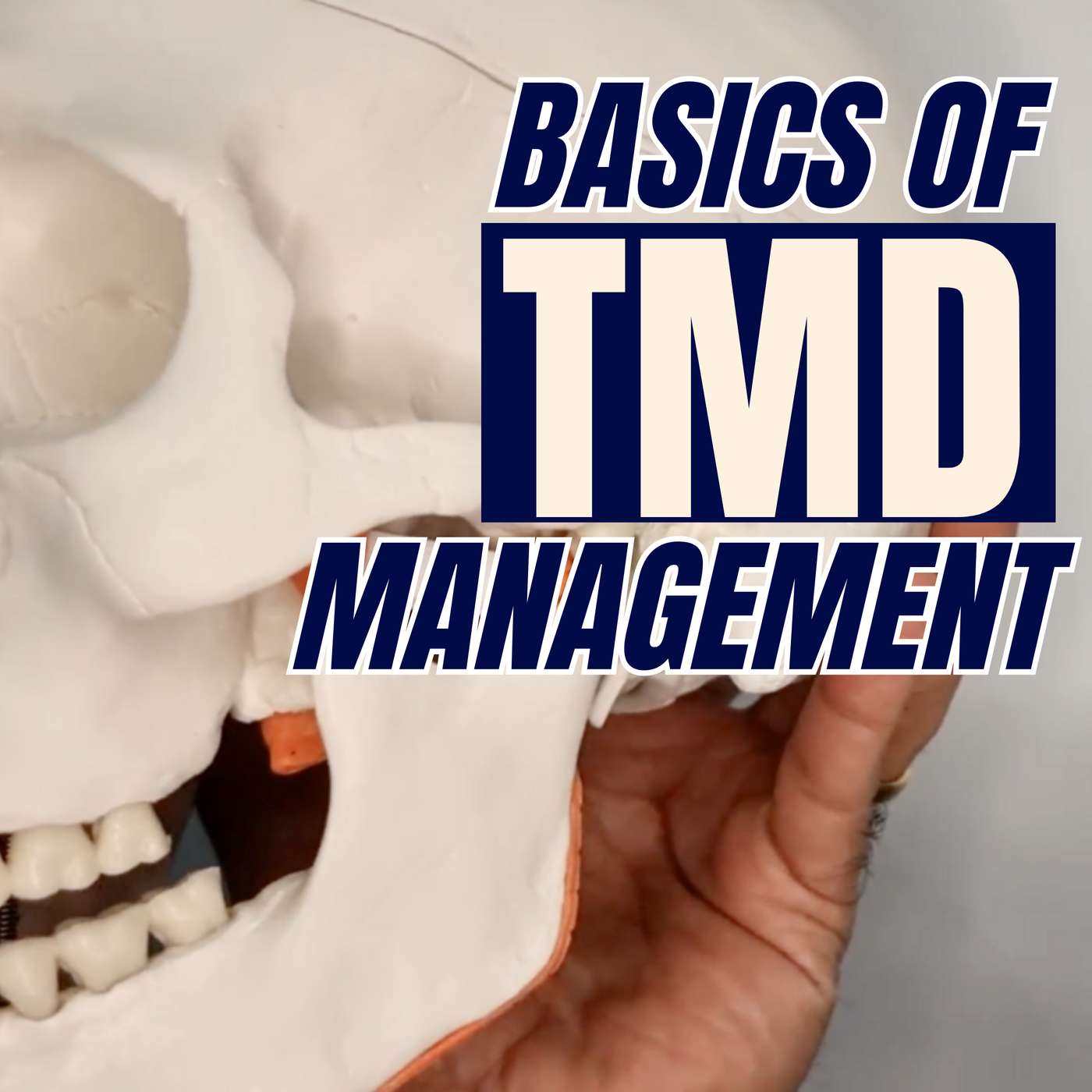 Basics of TMD Management – PS016