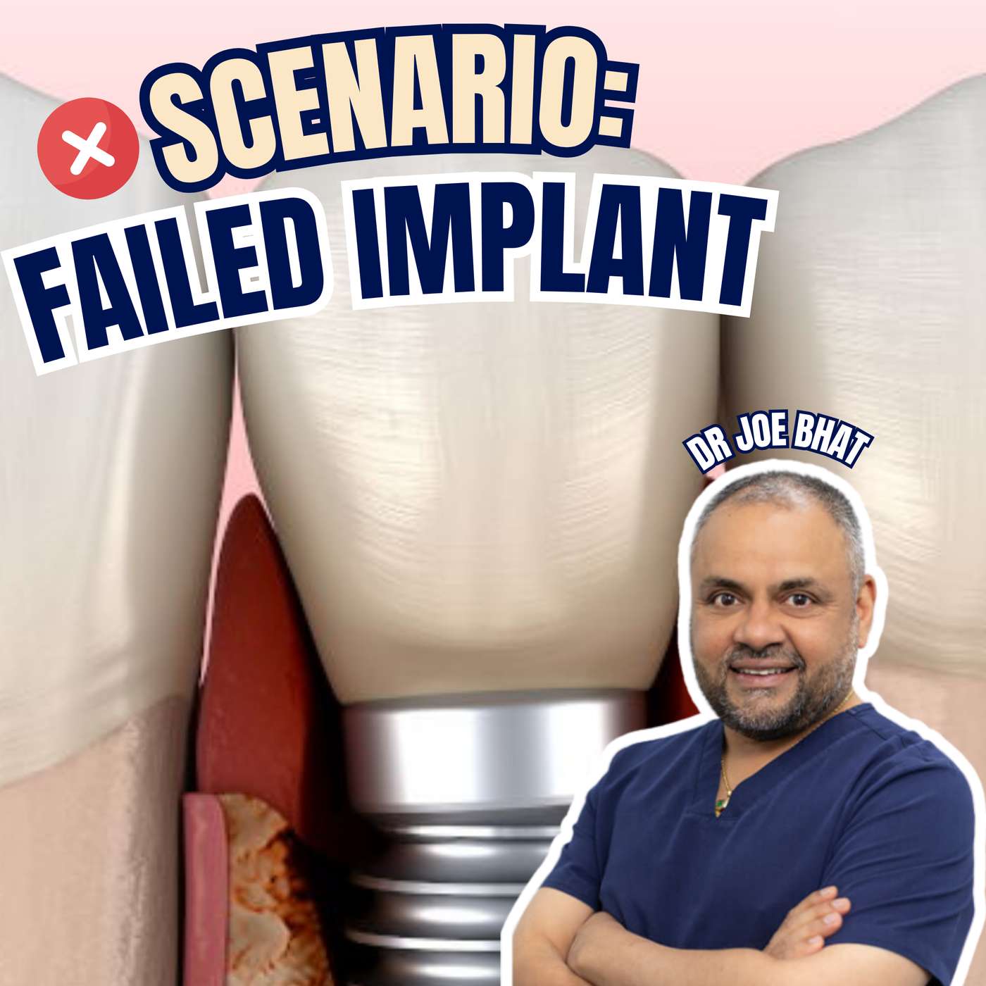 Implant Failed After 6 Months – Surgeon vs Restorative Dentist Medicolegal Considerations – GF022 episode artwork