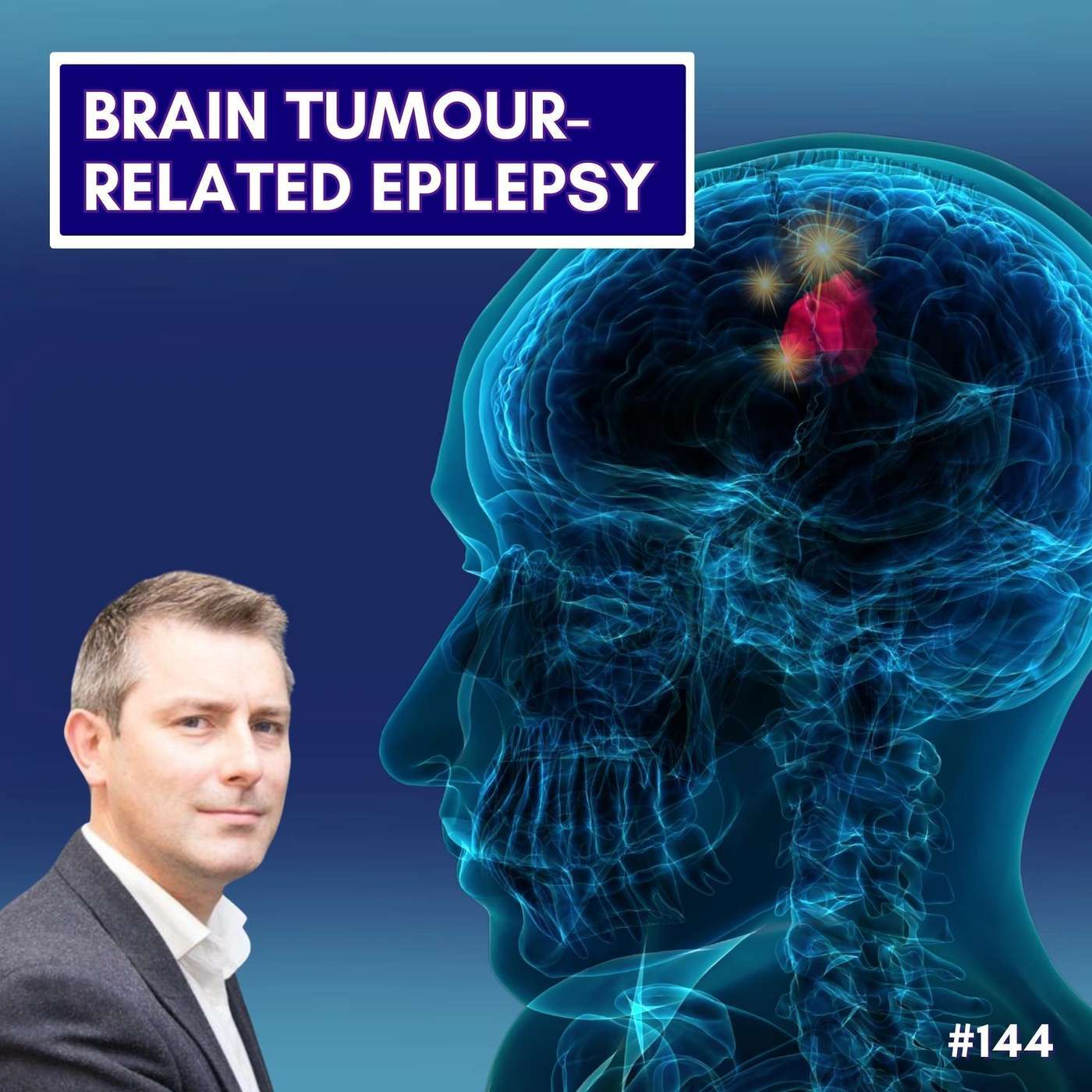 Brain Tumour-Related Epilepsy - Mark Cunningham episode artwork