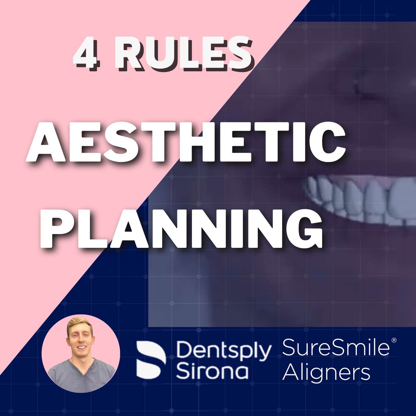4 Rules of Planning Aesthetic Dentistry (Ortho-Resto) – PDP129 episode artwork