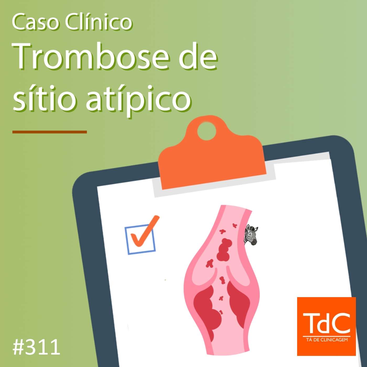 TdC 311: Caso clínico de Trombose de sítio atípico
