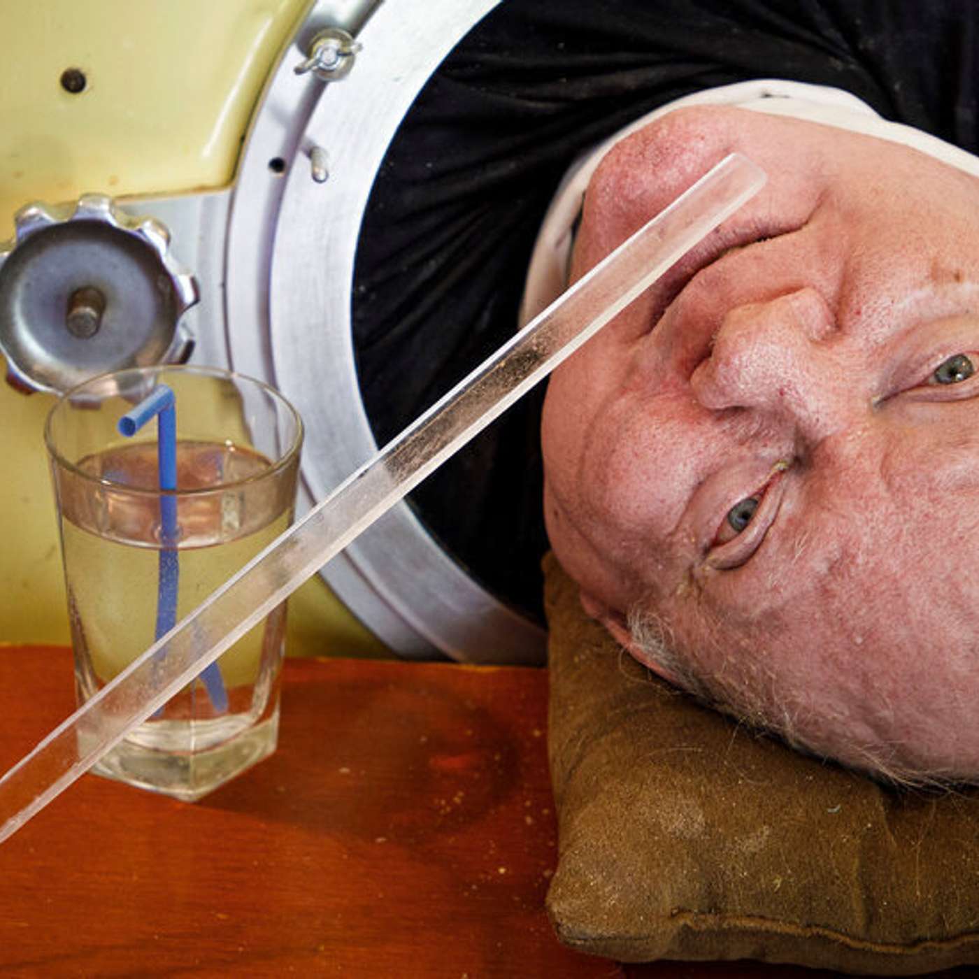 FAA Greenlights Starship Launch, Iron Lung Man Dies at 78, Urgent Methane Emission Cuts, Early-Onset Cancer Screening Push, and more...