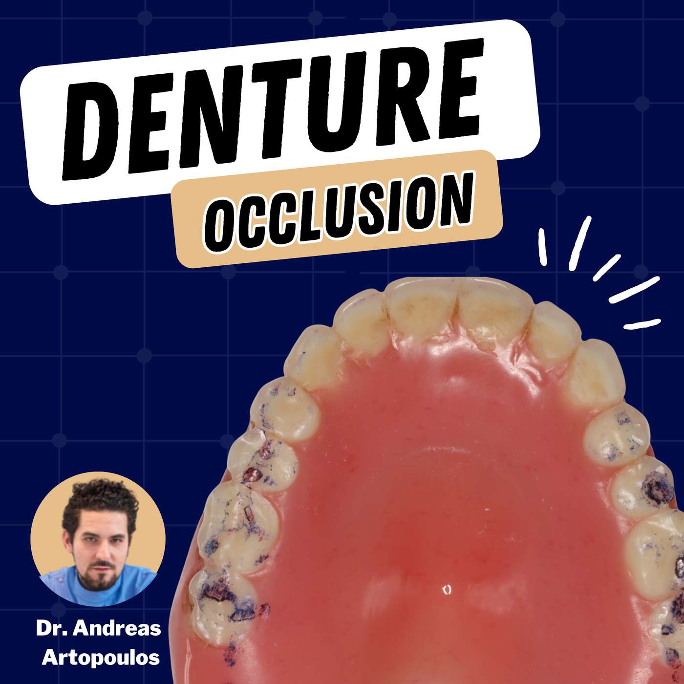 Occlusion for Complete Dentures – PDP162 episode artwork