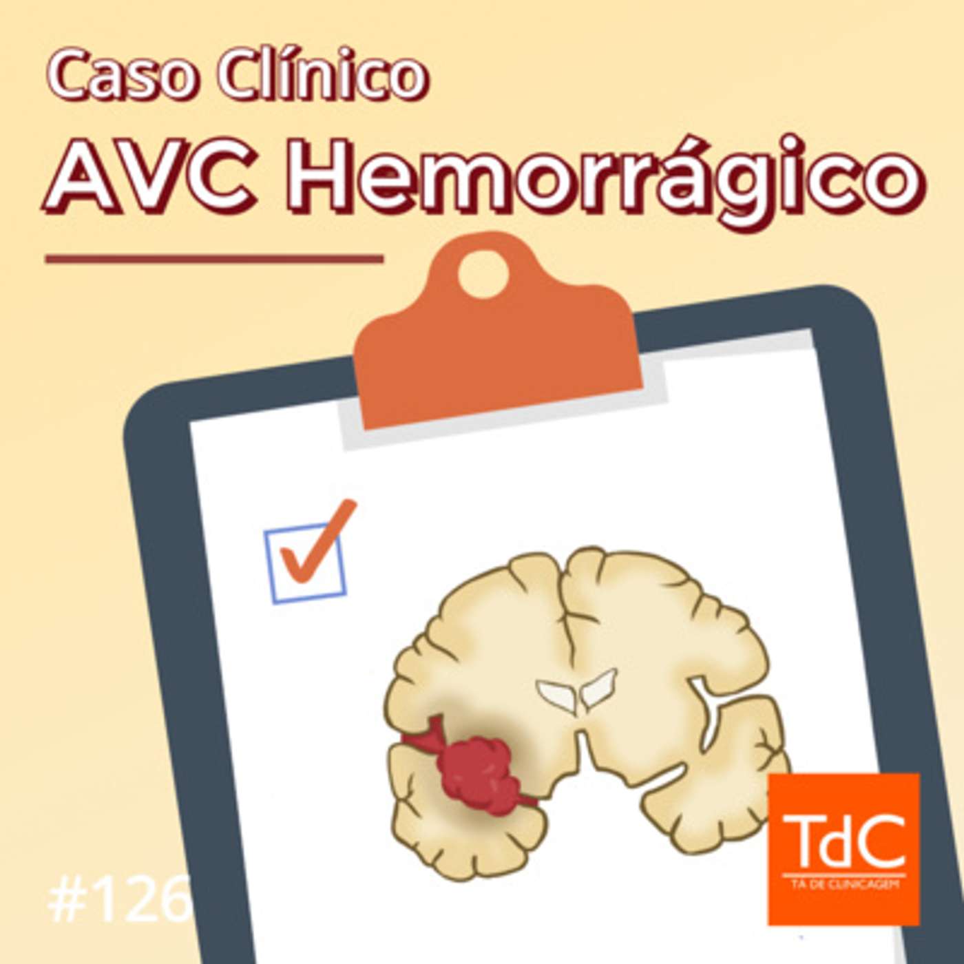 TdC 126: Caso Clínico de AVC Hemorrágico