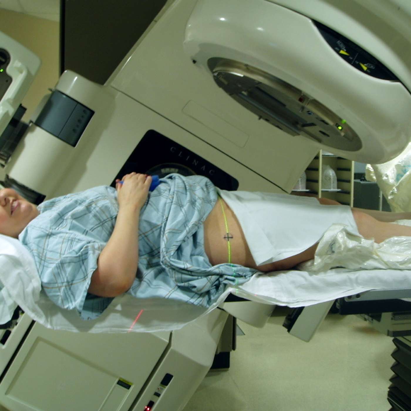 Mac explains the fundamental of Uterine Cancer Treatment.