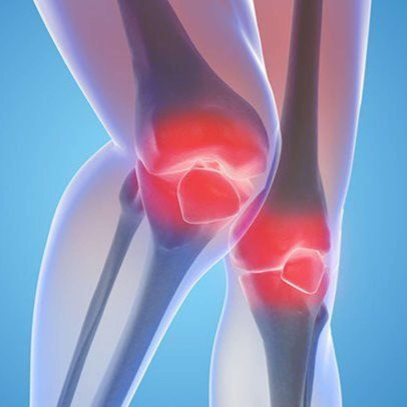 World Arthritis Day: Are You at Risk of Developing Arthritis? (12.10.20)