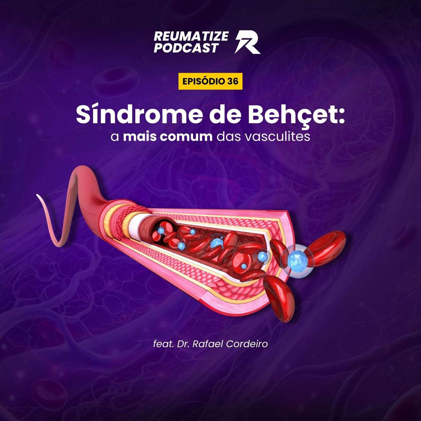 Ep. 36 - Síndrome de Behçet: a mais comum das vasculites Ep. 36 - Síndrome de Behçet: a mais comum das vasculites
