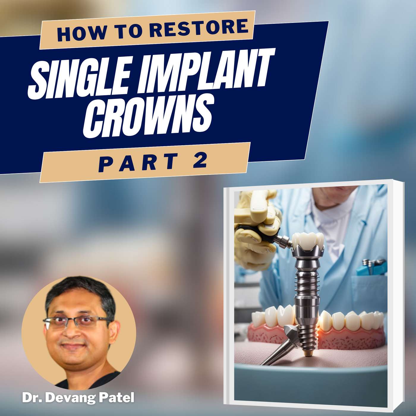 An Idiot’s Guide to Restoring Single Implant Crowns Part 2 – PDP157 episode artwork