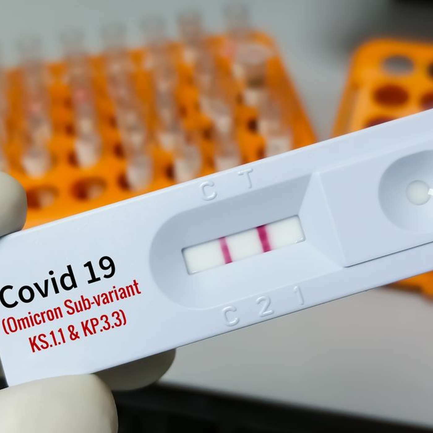 New COVID Variant XEC Emerges, Handheld Blood Test Revolutionizes Diagnostics, Blood Test Predicts Preeclampsia Risk, AI Model Detects Early Alzheimer's, and more...