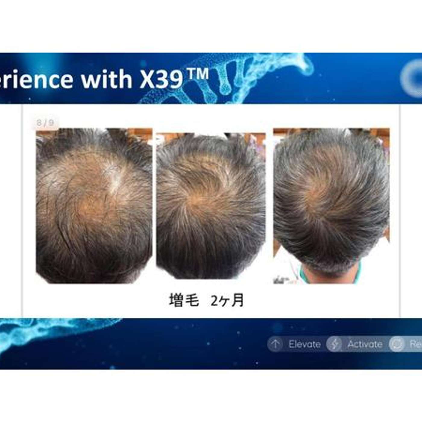 [LifeWave] Natural protocols for thinning hair with Dr. Dennis Part 1 episode artwork