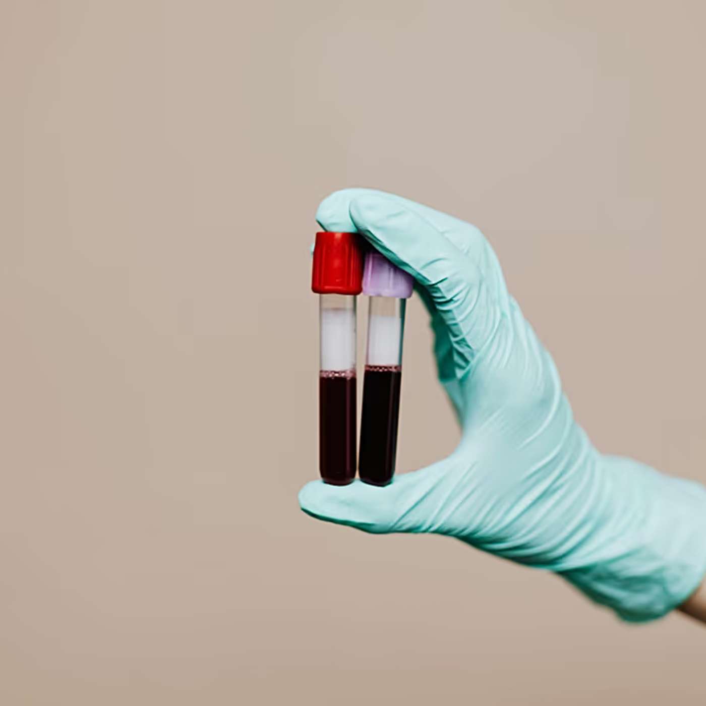 Blood Test Predicts Senior Survival, Peanut Shells Make Graphene Fast, AI Framework Improves Metal Printing, Giant Coral Colony Found, and more...