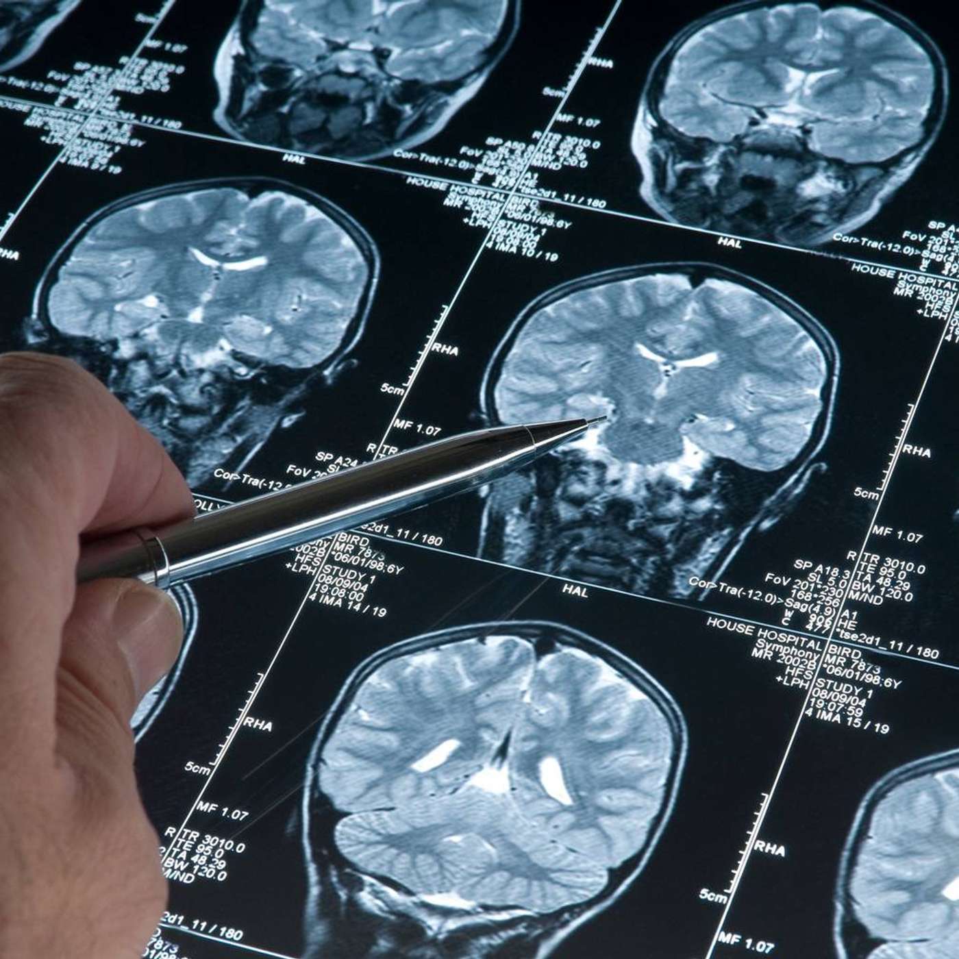 Study Sparks Neurogenesis Debate, Study Links Cancer to Genetic Mutation, Harvard Unveils AI COVID Variant Tool, Hiroshima University Unveils Stem Cell Breakthrough, and more...