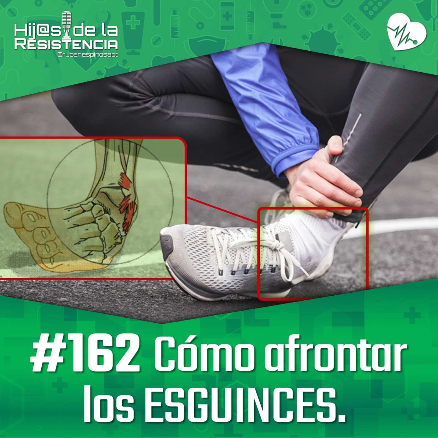 #162 Cómo afrontar LOS ESGUINCES