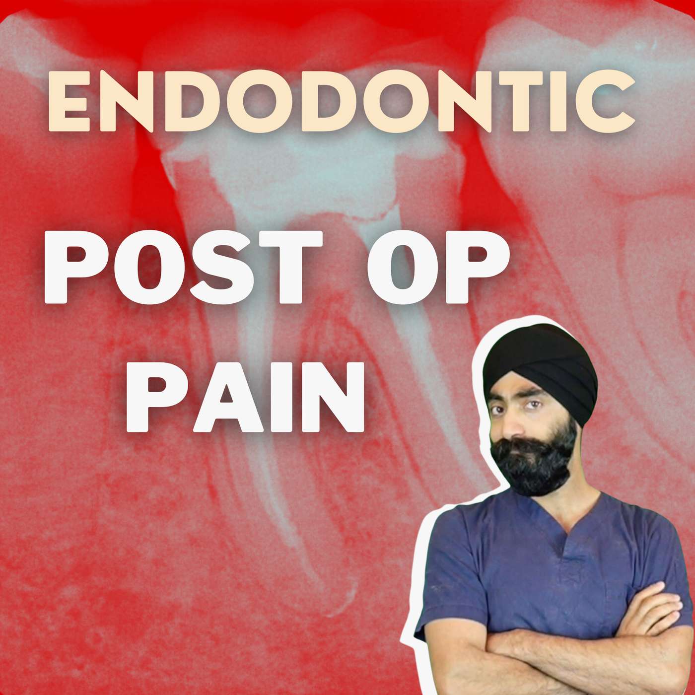 Post Operative Pain after Endodontics – Prevention and Management – GF017 episode artwork