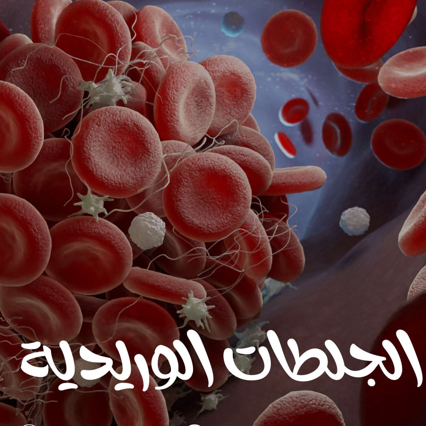 الجلطات الوريدية