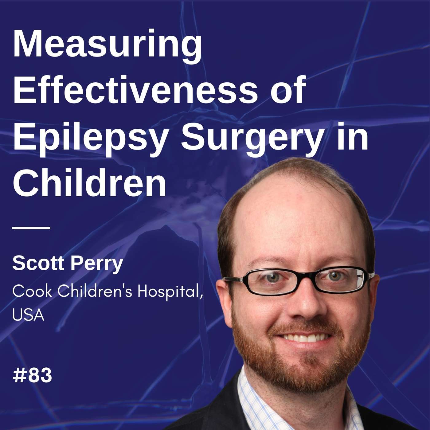 Measuring Effectiveness of Epilepsy Surgery in Children - M. Scott Perry #01 episode artwork