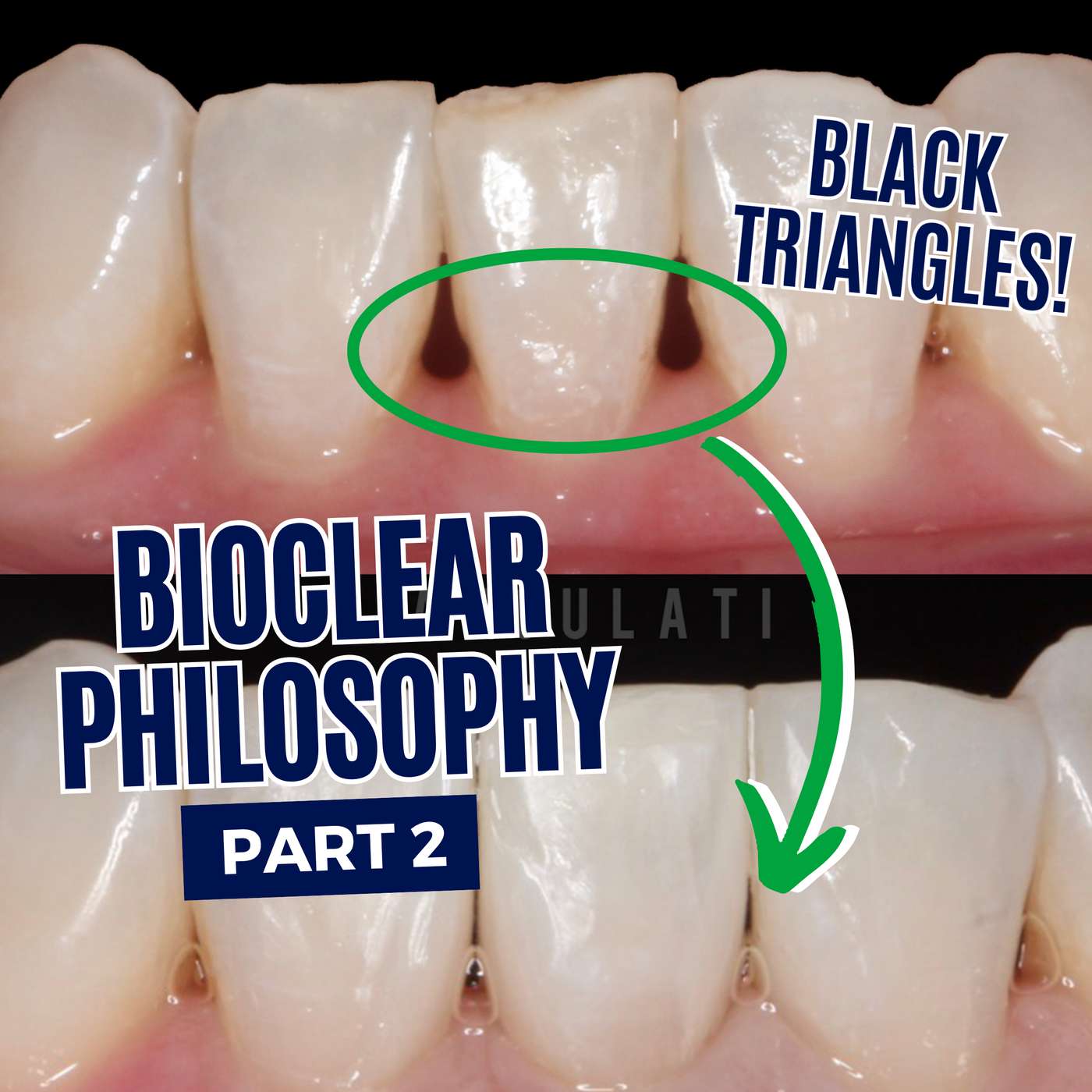 The Bioclear Philosophy of Adhesive Dentistry – Part 2 (Anterior) – PDP179 episode artwork
