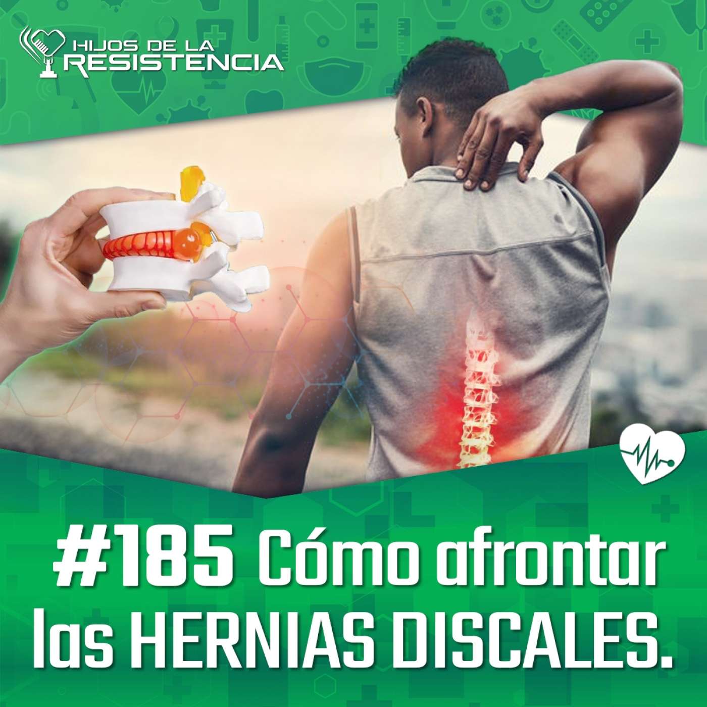 #185 Cómo afrontar las HERNIAS DISCALES.
