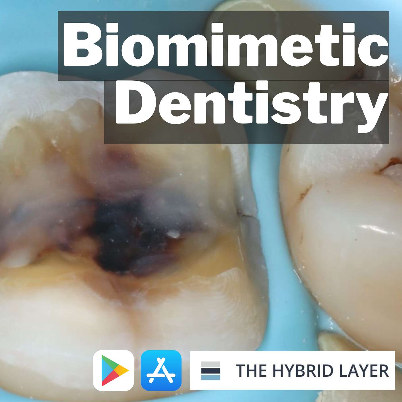 Biomimetic Dentistry – What Actually Is It? – PDP135 episode artwork