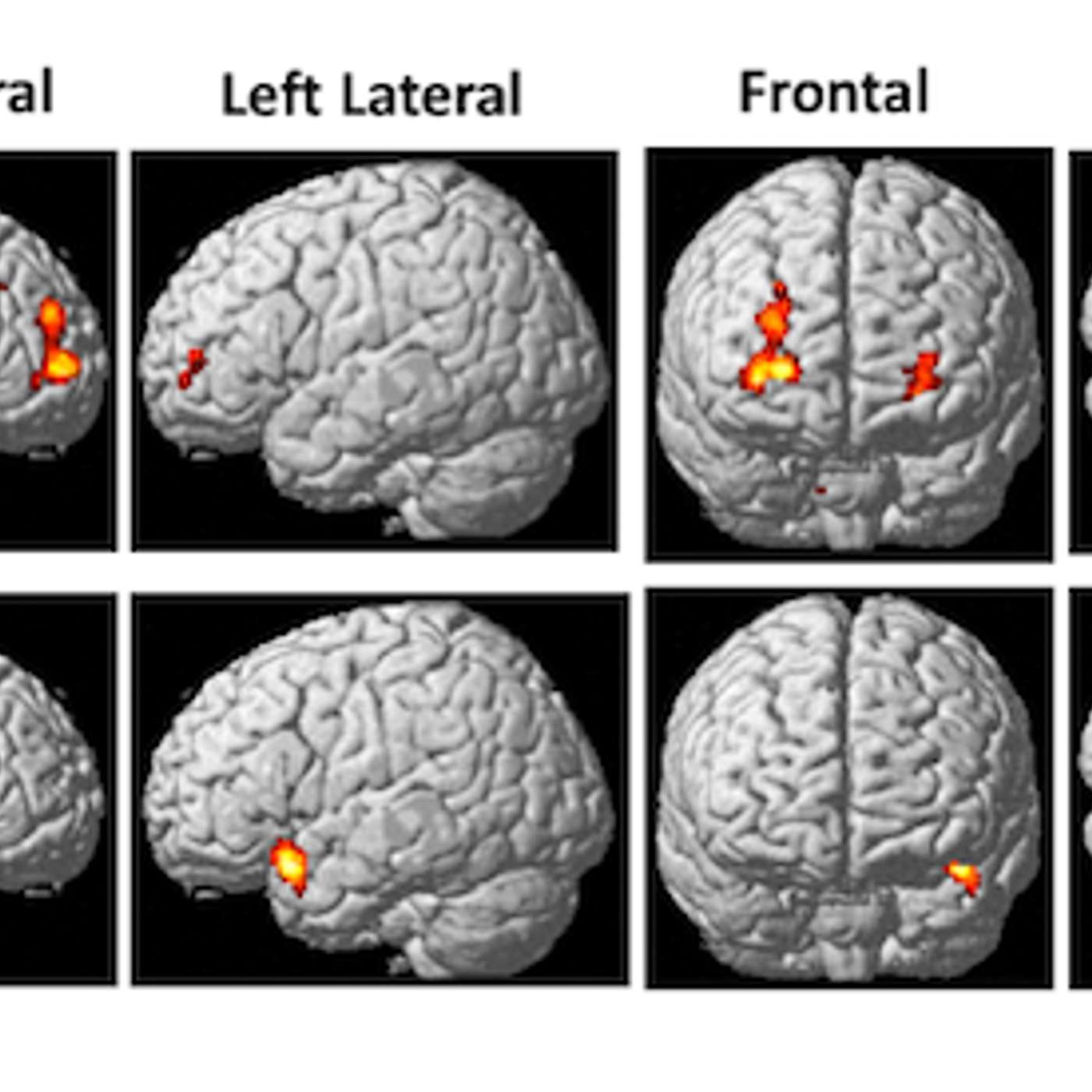 AI: Sleep Computational Neuroscience, Dreams, Loneliness, and Predictive Coding