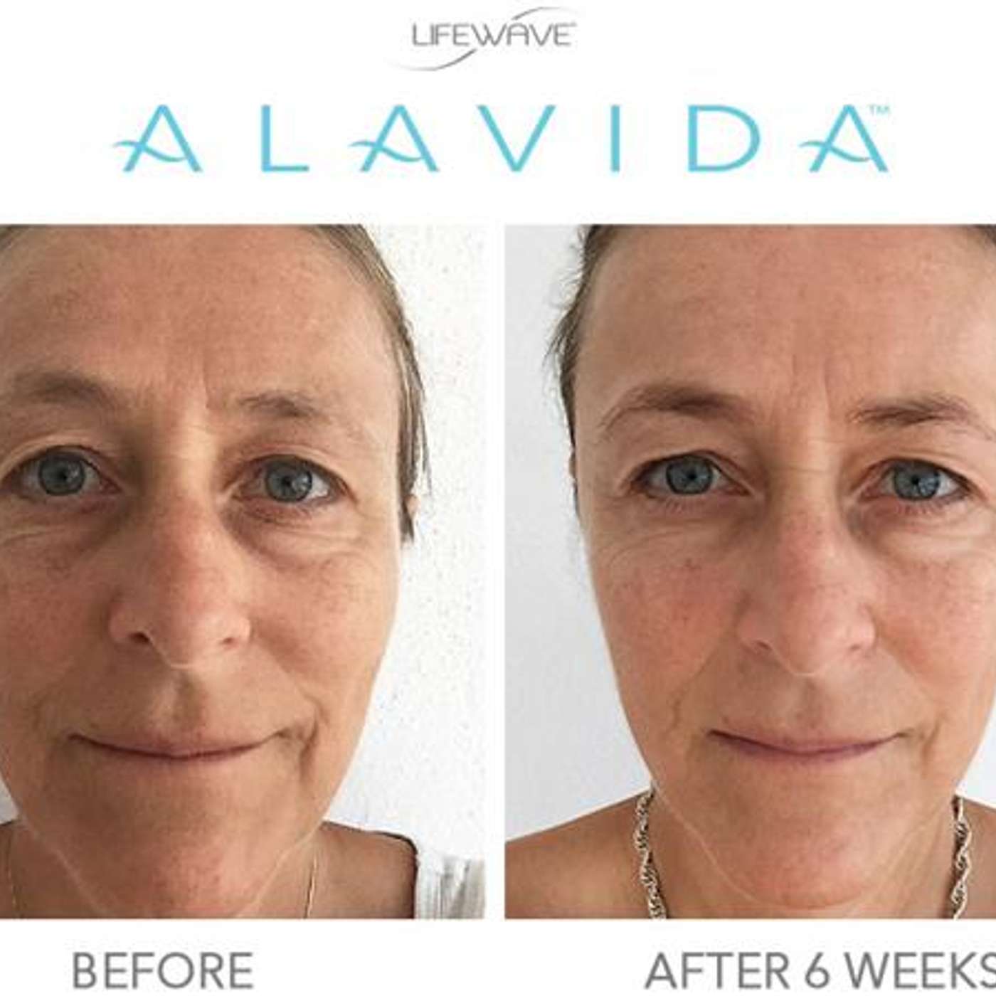 Healthier Skin in 3 Weeks - LifeWave's NEW Alavida Skin Care with David Schmidt episode artwork