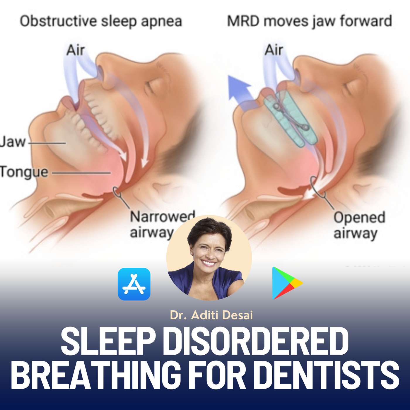 Sleep Disordered Breathing and Dentistry – PDP139 episode artwork