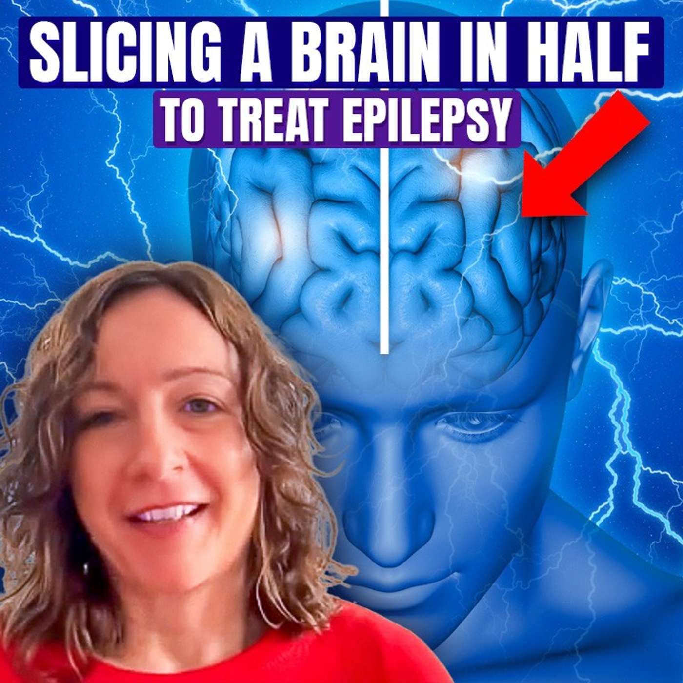 Slicing a Brain In Half To Treat Epilepsy -  Georgia Ramantani episode artwork