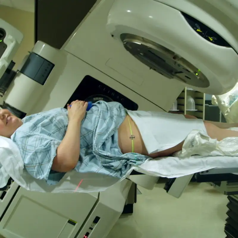 Mac explains the fundamental of Uterine Cancer Treatment.
