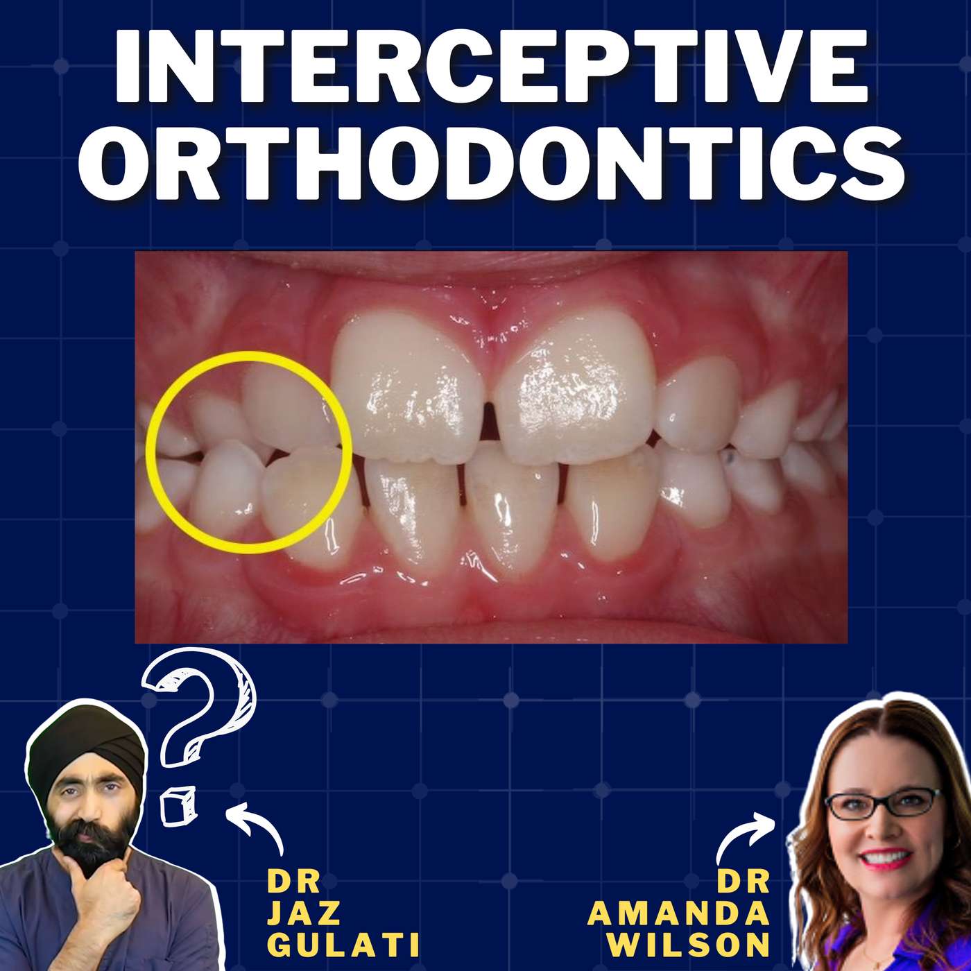 Interceptive Orthodontics for the General Dentist – PDP128 episode artwork