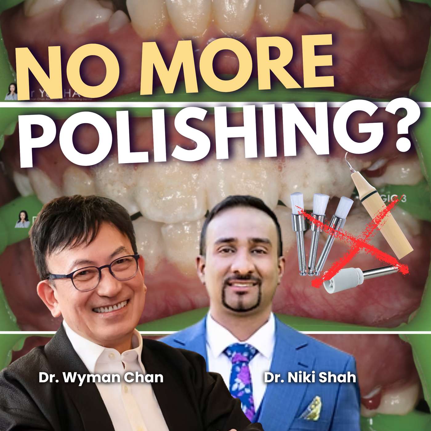 No More Air Polishing or Prophy Paste! Revolutionary New Technique for Non Mechanical Prophylaxis - PDP284