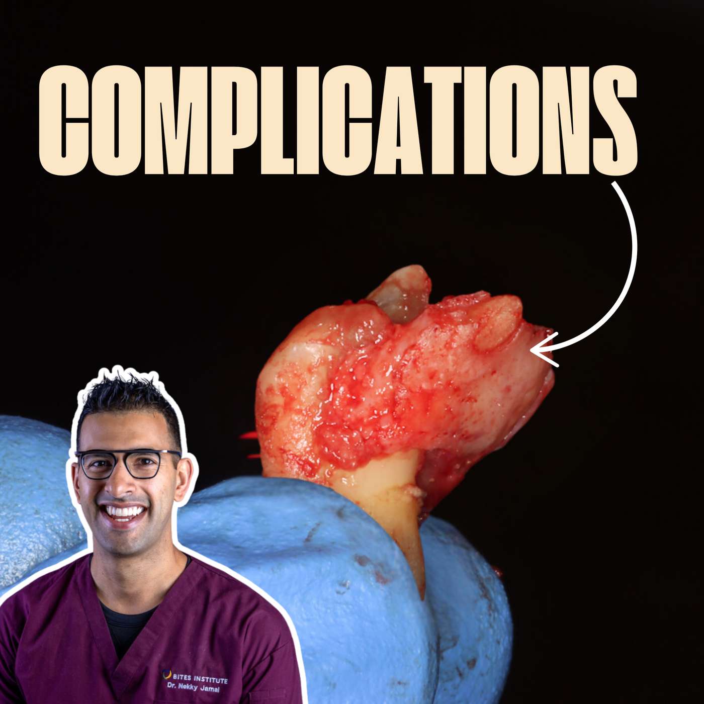 Managing Extractions Complications with Nekky Jamal – PDP210 episode artwork