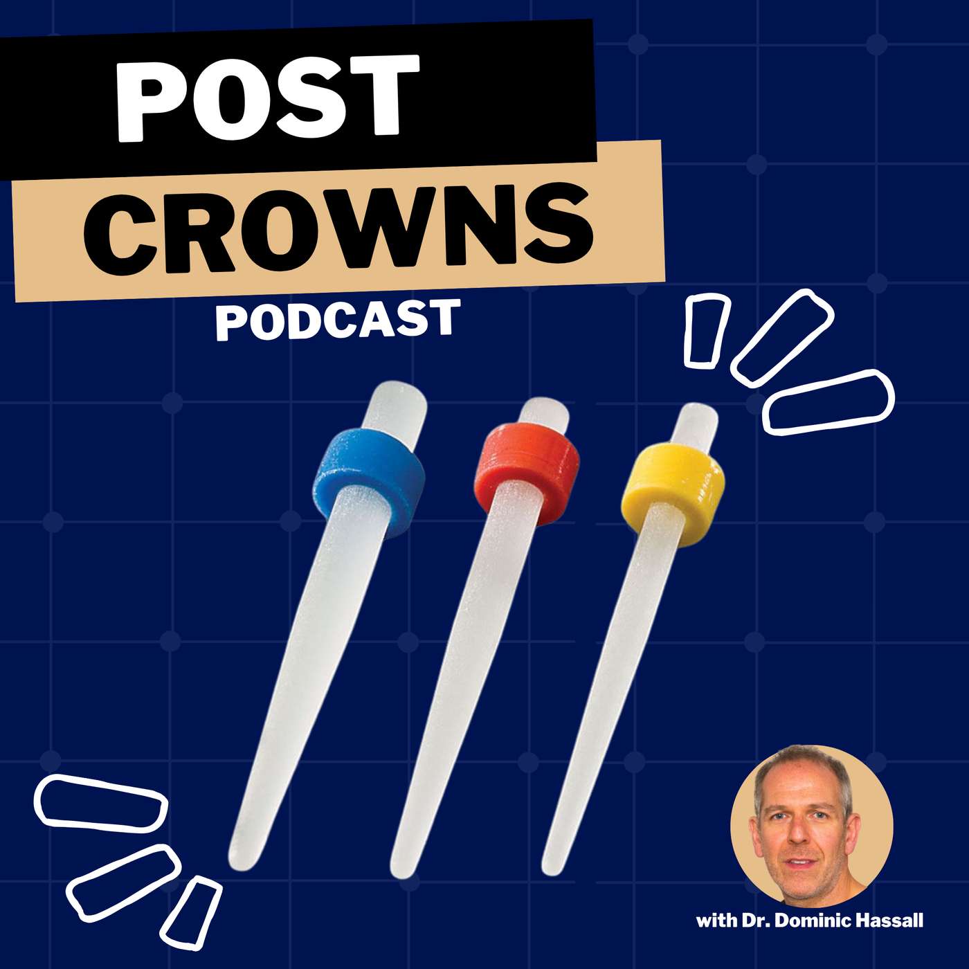 PDP154 – Post Crowns – Historical Technique or Necessary Solution for Compromised Teeth? episode artwork