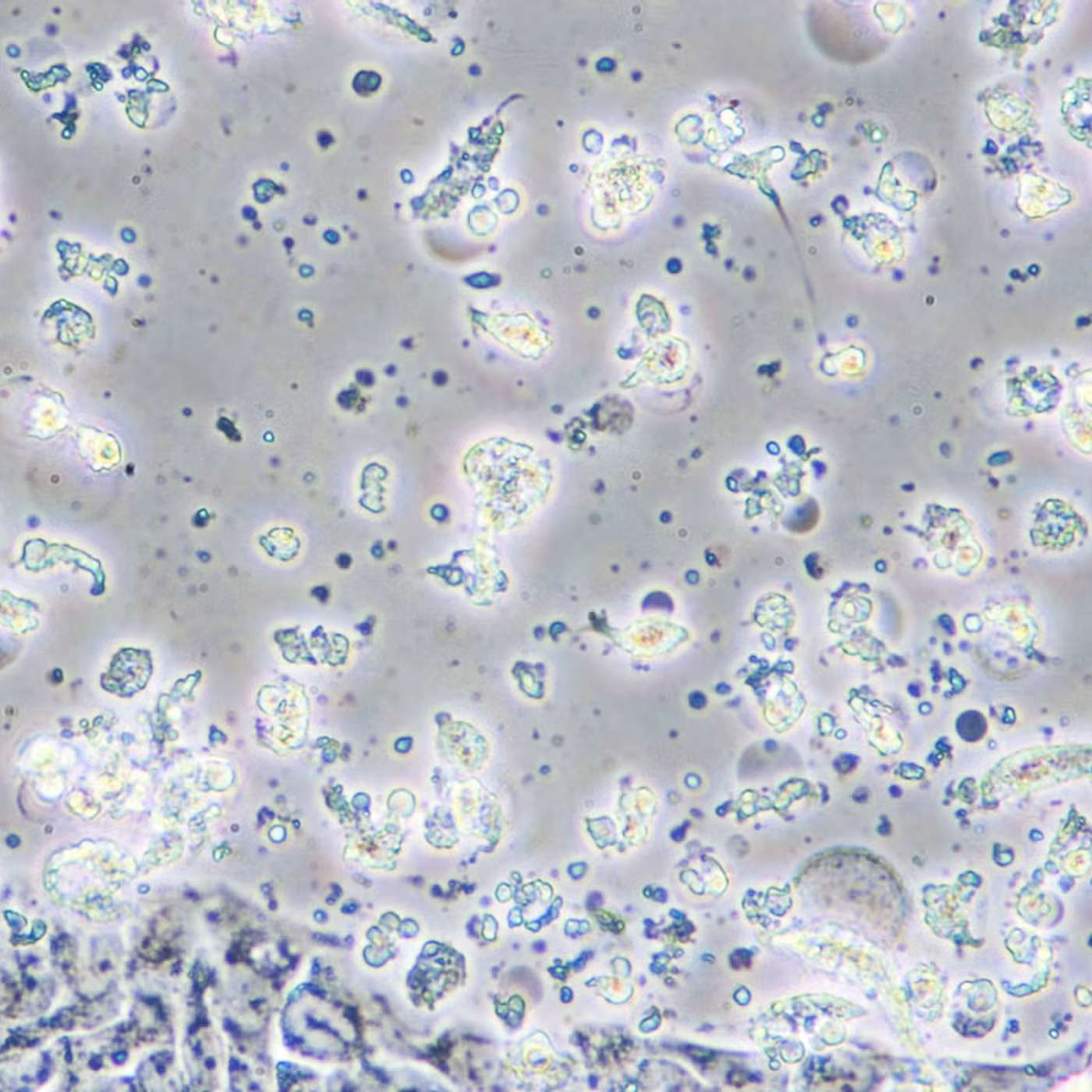 GSK and Oxford Launch Cancer Vaccine, AI Models Achieve Self-Replication, ADHD Linked to Shorter Lifespan, MCJ Protein Revolutionizes Obesity Research, and more...