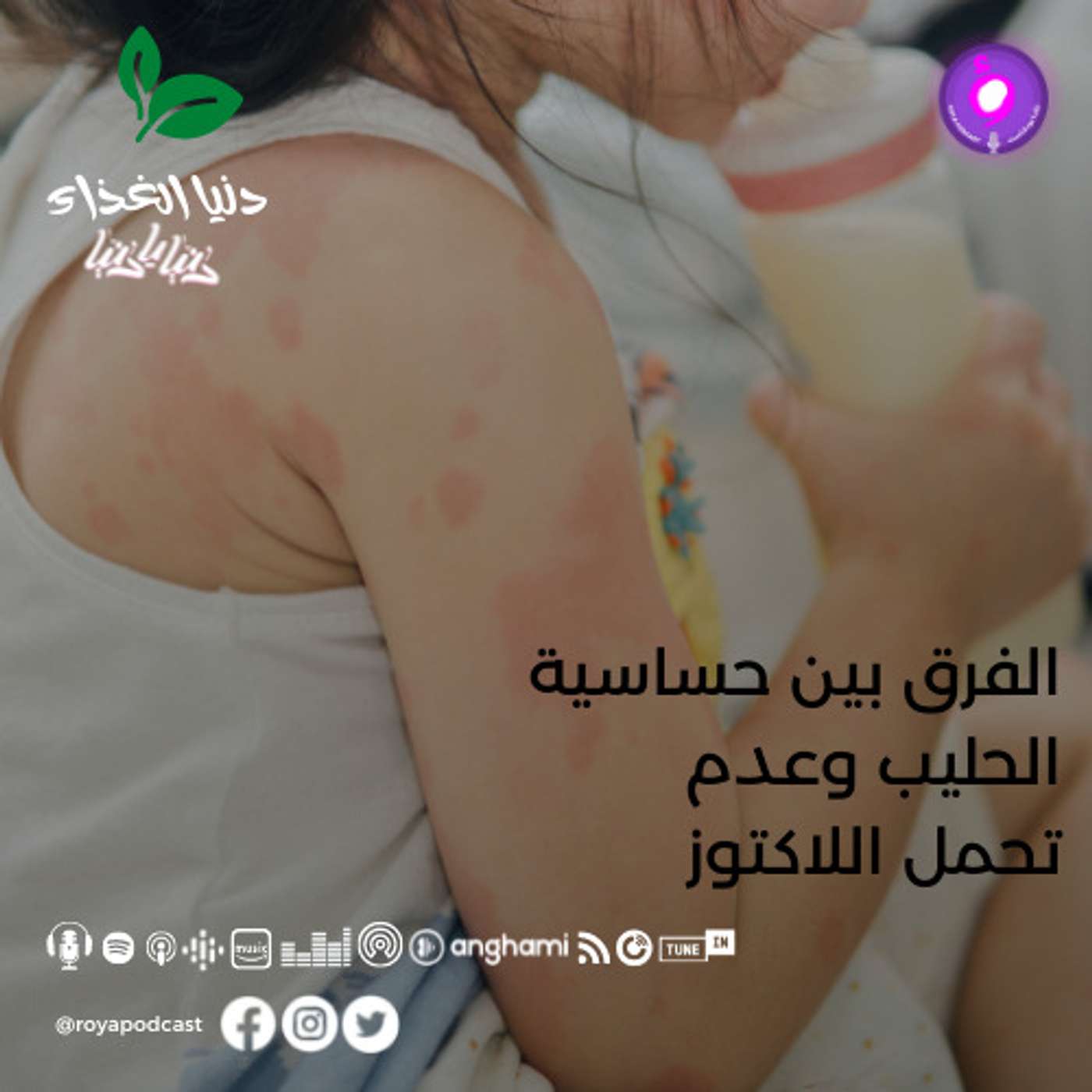 الفرق بين حساسية الحليب وعدم تحمل اللاكتوز