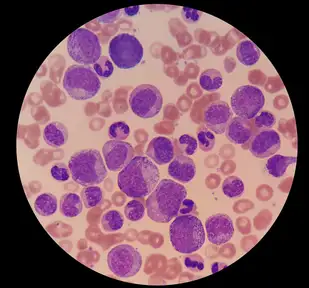 Medical Laboratory Science Careers