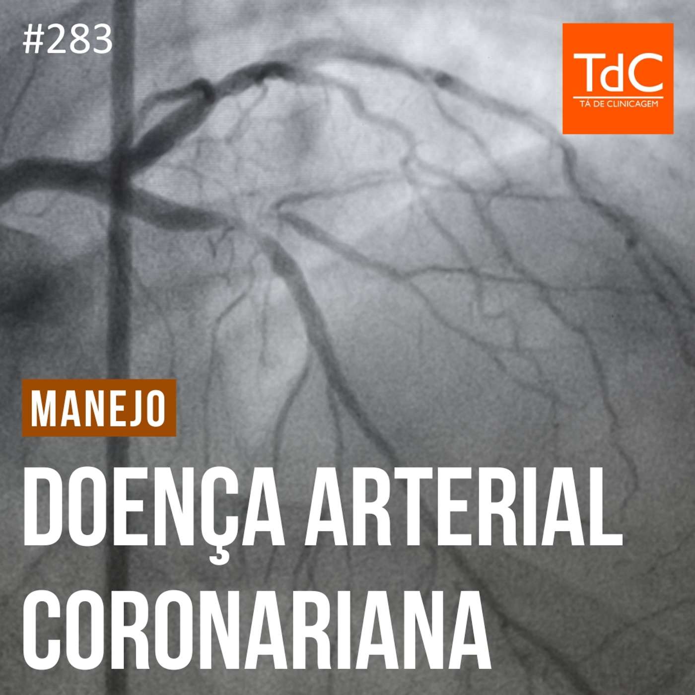 TdC 283: Manejo de Doença coronariana crônica