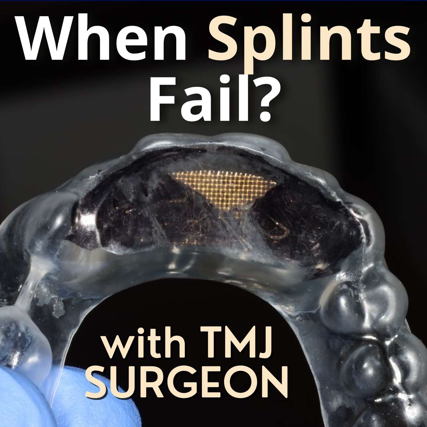 What Happens When Occlusal Splints Don’t Work? – PDP118 episode artwork
