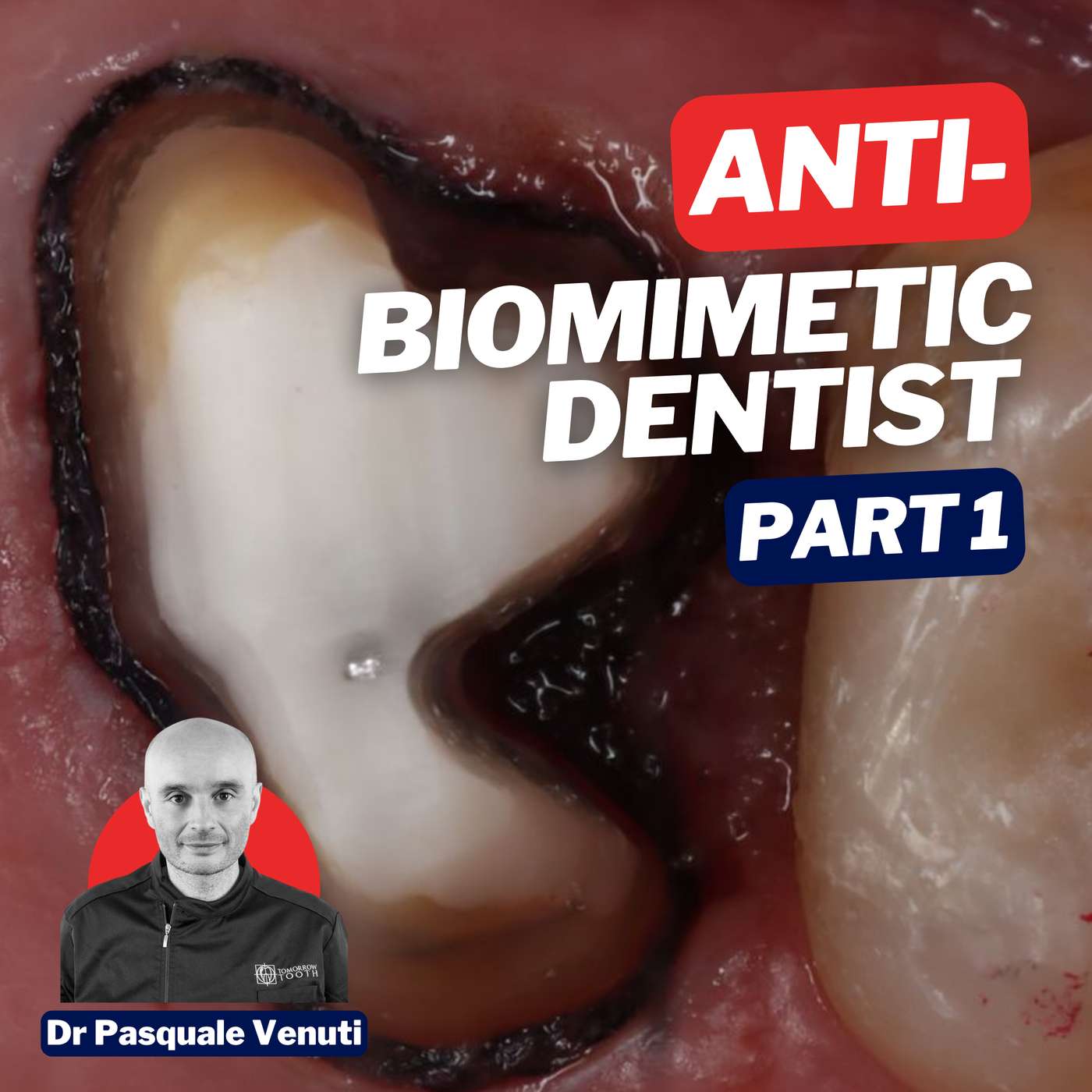 The ‘Anti-Biomimetic Dentist’ – Restorative Lessons from Pasquale Venuti Part 1 – PDP152 episode artwork