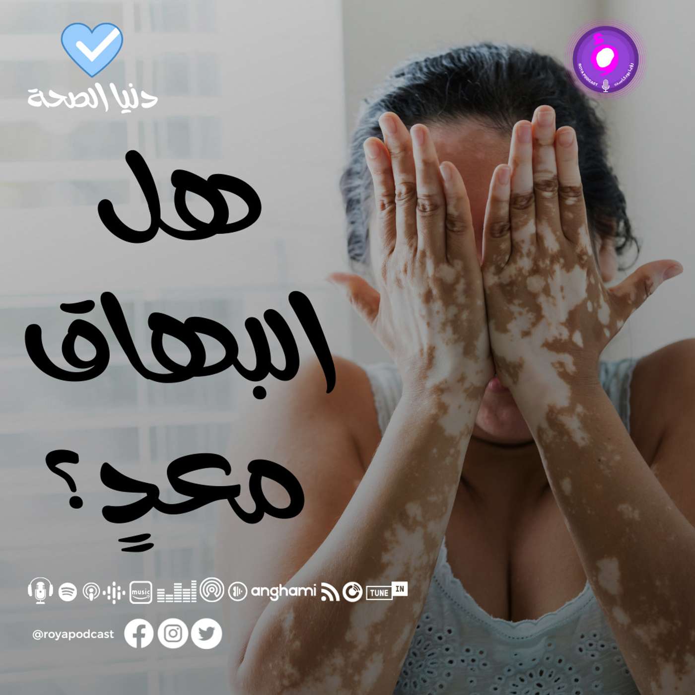 هل البهاق معدٍ؟