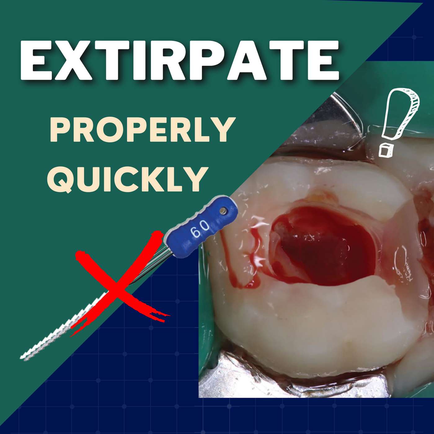 How To PROPERLY and QUICKLY Extirpate (Acute Pain) – GF016 episode artwork