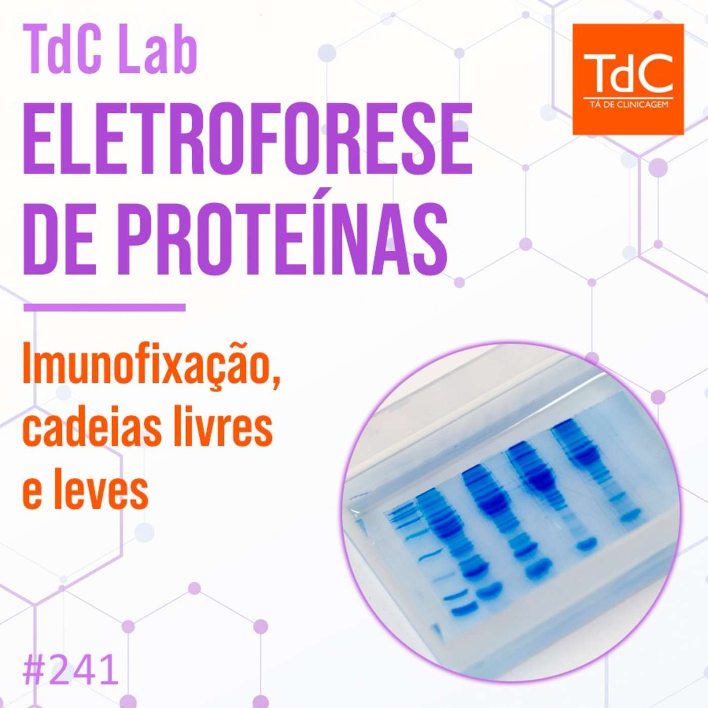 TdC 241: TdC Lab - Eletroforese de proteínas, imunofixação e cadeias leves livres