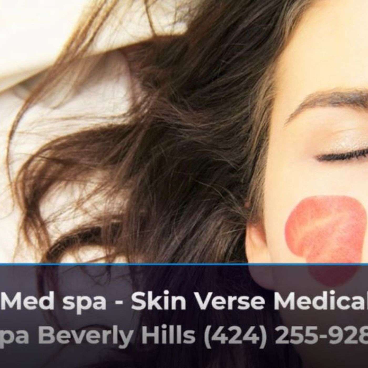 Skin Verse Medical Spa Beverly Hills