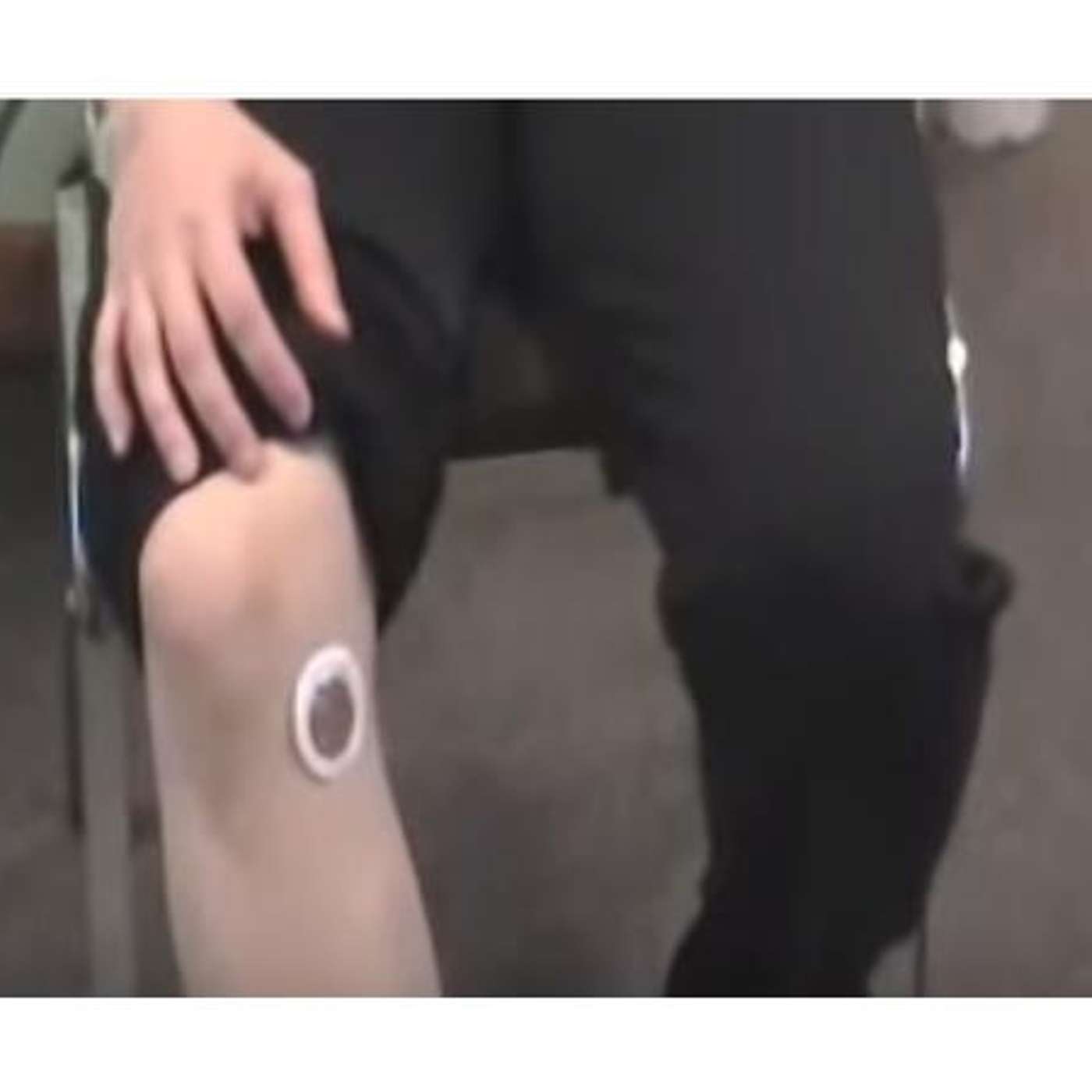 Top 5 ways to use Phototherapy Patches for Knee Pain episode artwork