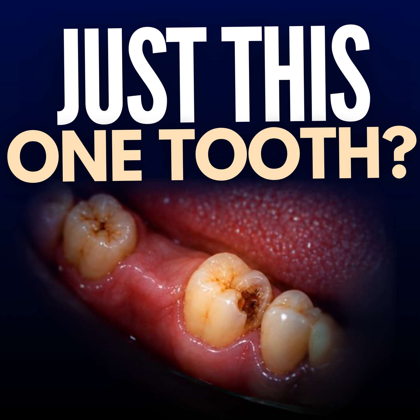 How to Talk to Patients Who Only Want One Tooth Fixed - PDP285 episode artwork