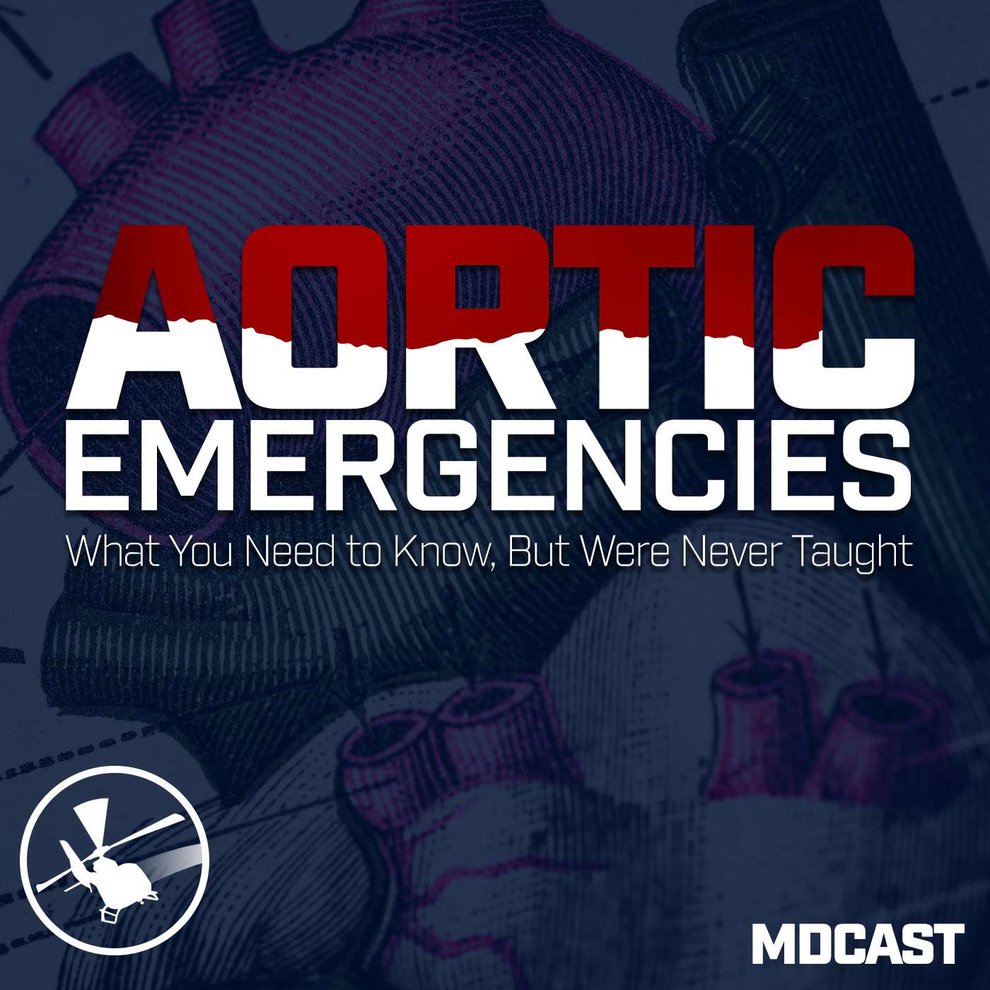 MDCAST:  Aortic Emergencies - What You Need to Know, But Were Never Taught